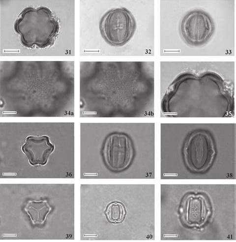 M.A.V. Cruz-Barros et al.: Flora Polínica do PEFI: Melastomataceae 543 Figuras 31-41. Fotomicrografias dos grãos de pólen dos gêneros Mouriri, Ossaea e Pleiochiton (Melastomataceae). Figuras 31-35.