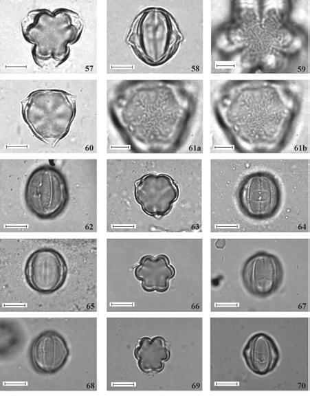 M.A.V. Cruz-Barros et al.: Flora Polínica do PEFI: Melastomataceae 549 Figuras 57-70. Fotomicrografias dos grãos de pólen do gênero Tibouchina (Melastomataceae). Figuras 57-59.