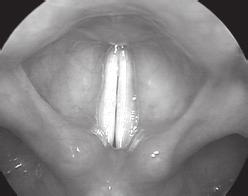 ligamentos vocais São esses ligamentos que efetivamente vibram com a passagem do ar vindo do sistema respiratório pela laringe (BARBOSA; MADUREIRA, 2015).