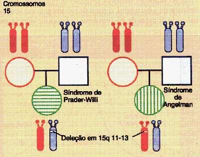 Imprinting resultante de uma deleção: se a deleção ocorrer no cromossomo 15 paterno, a criança apresentará a