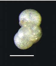 Globorotalia sp; 10-12: Neogloboquadrina