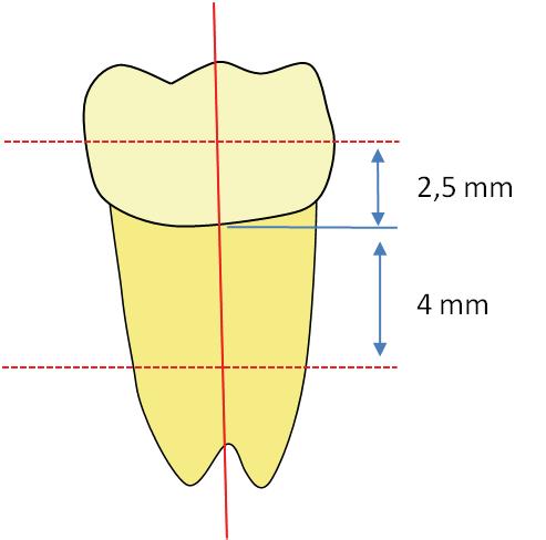 66 Figura 9 Esquema representando a secção de terceiro molar 2,5 mm acima e 4 mm abaixo da união amelo-cementária.