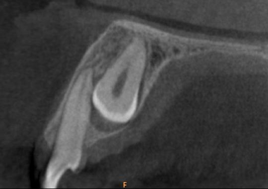 TCFC 3D da Faculdade de Odontologia da Universidade Federal da Bahia Os dados referentes à anatomia