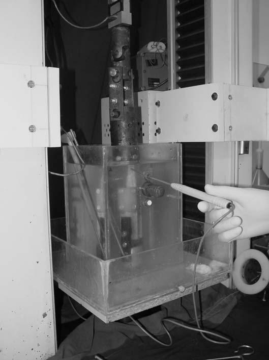 Em seguida, descia-se a junta superior da máquina em uma faixa de 15 a 20% do comprimento inicial, e então era aplicada à estrutura a radiofreqüência, através da ponteira do aparelho Vulcan, da PCE