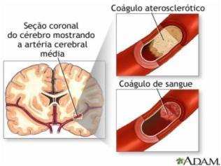 Funcionalmente comprometida, mas estruturalmente viável.