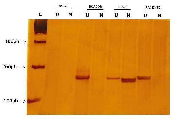 (A) Linha L: marcador de peso molecular Low DNA Mass Ladder (INVITROGEN); linhas U: fragmentos relativos ao produto de PCR de 154pb realizado com oligonucleotídeos específicos para o gene não