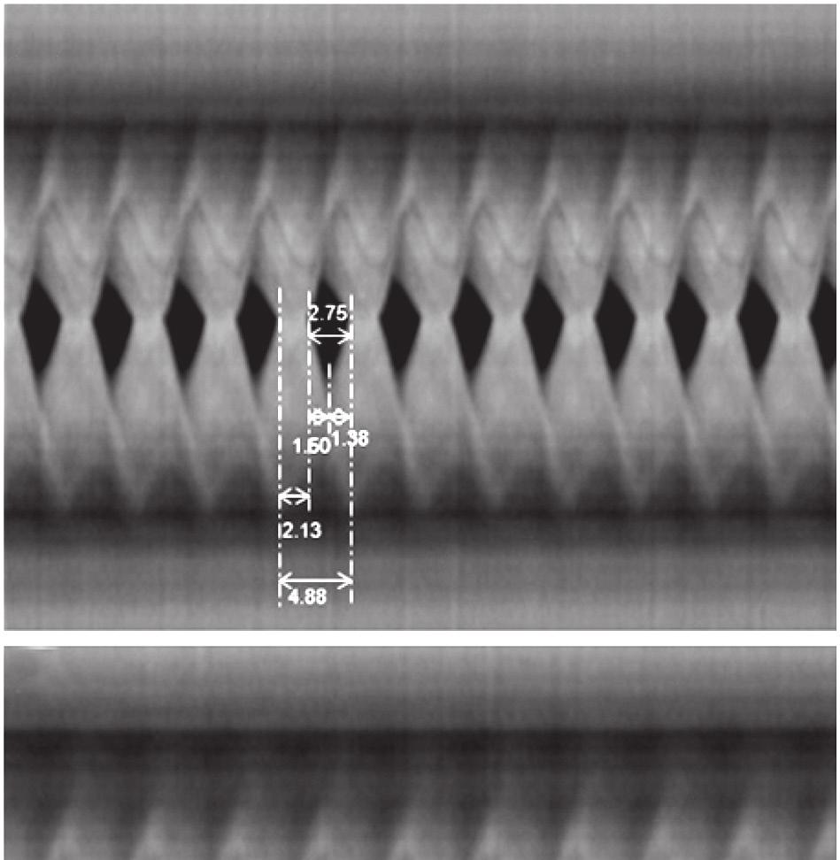 Acústica, quimografia e exercícios vocais 581 A B Figura 3. Imagens de quimografias de alta velocidade exemplificando as fases do ciclo glótico das pregas vocais de uma amostra feminina.