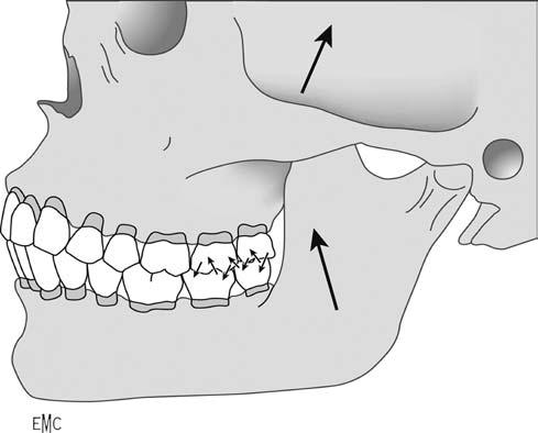 Introdução à Anatomia Dentária Figura 2.