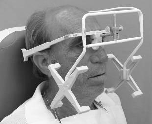 Disfunções Temporomandibulares: Causas e Diagnóstico Figura 3.4: Sistema K7 Evaluation System da Myotronics (imagem de [Garcia, 2003]). Figura 3.5: Íman utilizado para detectar o movimento, montado sobre os incisivos (imagem de [Leles, 2003]).