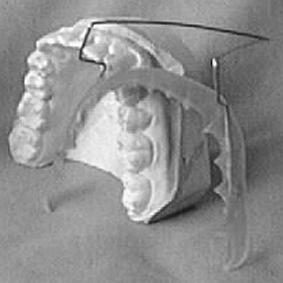 Disfunções Temporomandibulares: Causas e Diagnóstico técnica ao estudo da cinemática da articulação temporomandibular, de modo a identificar todos os deslocamentos da mandíbula e do sistema do