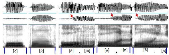 28), olhando o oscilograma obtido pelo piezoelétrico (em b), é possível perceber que a fase nasal da vogal nasal [õ], nos dois contextos de tonicidade, ocupa quase que toda a emissão da vogal, com