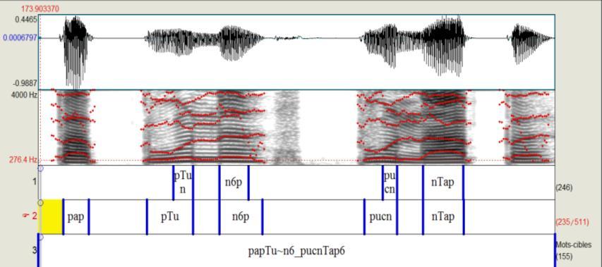 129 vezes: (i) uma para obter a duração da parte nasalizada do som-alvo, ou seja, aquela obtida do sinal nasal captado pelo piezolelétrico, que foi realizada com base na primeira camada de etiquetas