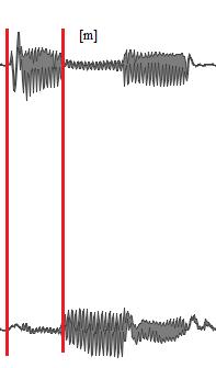 140 masculino. Quando o contexto anterior foi ocupado pela consoante nasal palatal, o percentual médio de nasalização progressiva passou a 88,4% para o sexo feminino e a 87,35% para o sexo masculino.