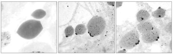 Indivíduo de Xyleus discoideus angulatus de Lagoa do Carro contendo variação inter-folicular no número de cromossomos B (0B-2B) (d-f). d) diplóteno, 2n=23 (0B). e) diacinese, 2n=24 (1B).