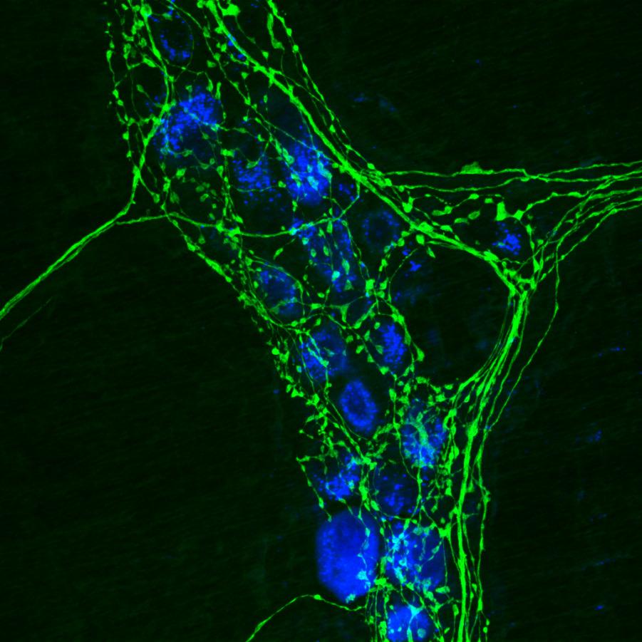 MICROSCOPIA DE LUZ histoquímica e citoquímica