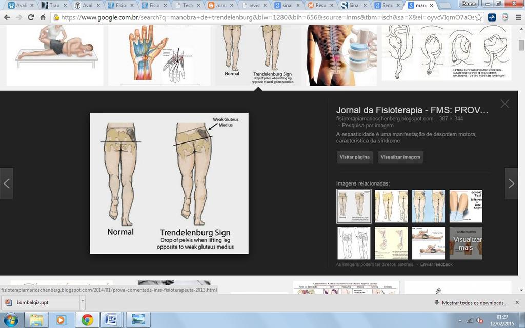 O paciente é posicionado em decúbito dorsal, com abdução, flexão e rotação externa do quadril. O tornozelo é posicionado sobre o joelho do membro inferior contralateral.