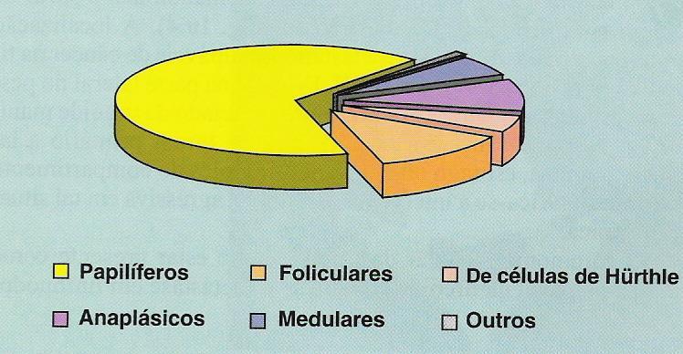 Distribuição histológica dos carcinomas