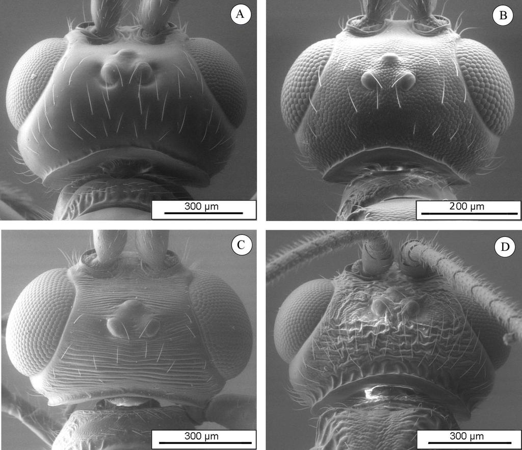 Figura 7. Variações na esculturação da cabeça nas espécies de Heterospilus sp. A, vértex liso. B, vértex granuloso. C, vértex estriado. D, vértex rugoso.