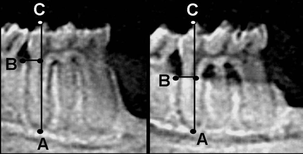 empregada para avaliar o nível ósseo alveolar em crânios macerados de ratos, permitindo quantificar o total de tecido ósseo destruído durante o período experimental (Crawford et al.