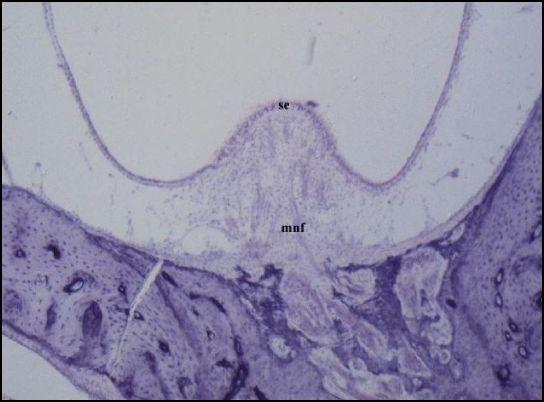 DUCTOS SEMICIRCULARES Lateral,