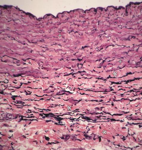 presença de lâminas elásticas nas artérias mas não nas veias Artéria íntima Veia m é d