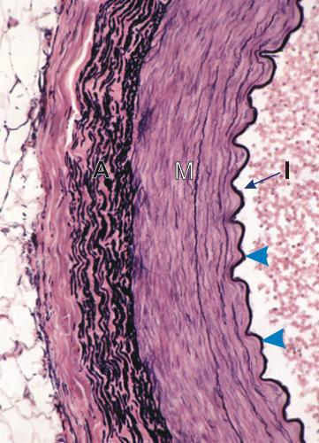 elástica interna (seta azul), músculo liso, conjuntivo com colágeno A)