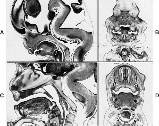 Nasal Cavidade oronasal Visão frontal Durante o desenvolvimento da