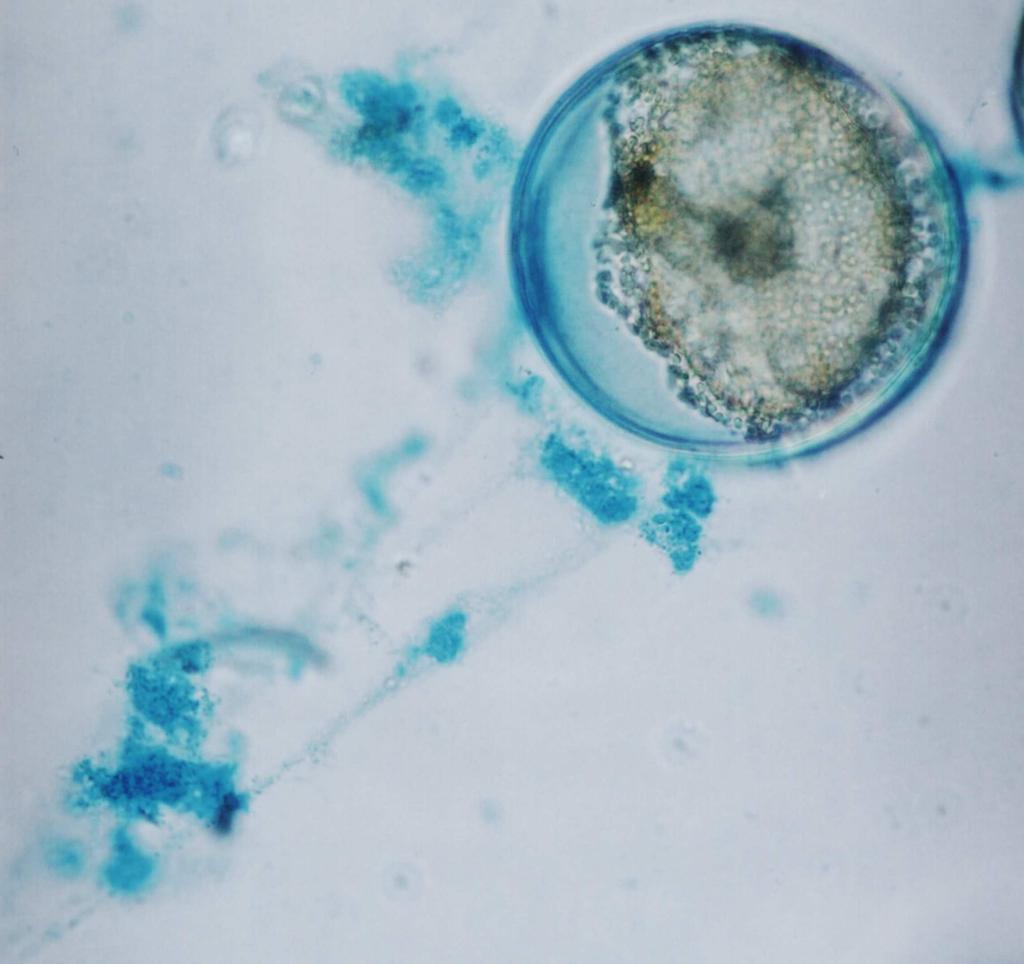 (MANZINAI et al., 1984). Através da coloração de Alcian Blue foi possível observar e confirmar a presença de compostos ácidos nas células da microalga C. wailesii.