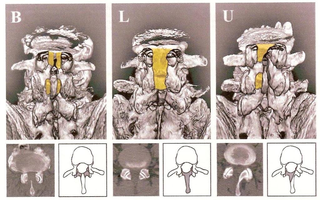 Tratamento cirúrgico Thomé MD.