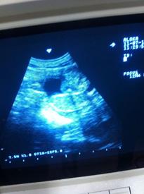 A Figura 6. Ultrassonografia para confirmação da prenhez em pacarana. A- crânio fetal e B- placenta tipo discoidal. B Tabela 2. Determinação das fases reprodutivas da fêmea de pacarana em cativeiro.