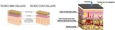 Tecido sem Celulite Tecido com celulite A linha i9 Fitness auxilia no aumento da microcirculação sanguínea, a promoção da