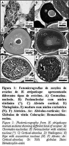 Desenvolvimento ovariano do Hypostomus strigaticeps 109 Figura 1. Fotomicrografias de secções de ovários de H. strigaticeps apresentando diferentes tipos de ovócitos. A) Cromatinanucléolo.