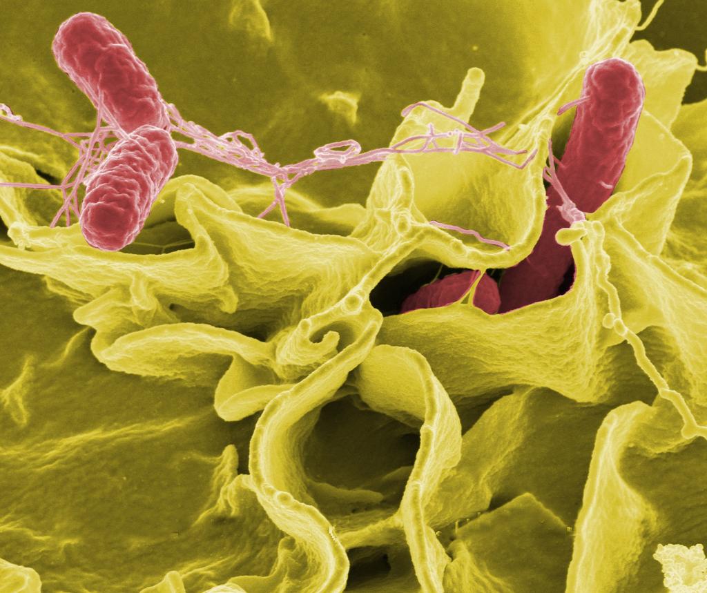 Salmonella typhi Bactéria responsável por causar febre tifoide (febre, diarreia e