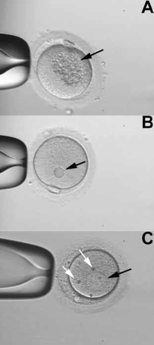 Correlação entre os dismorfismos oocitários e os resultados da fertilização in vitro - Cota A.M.M. et all.