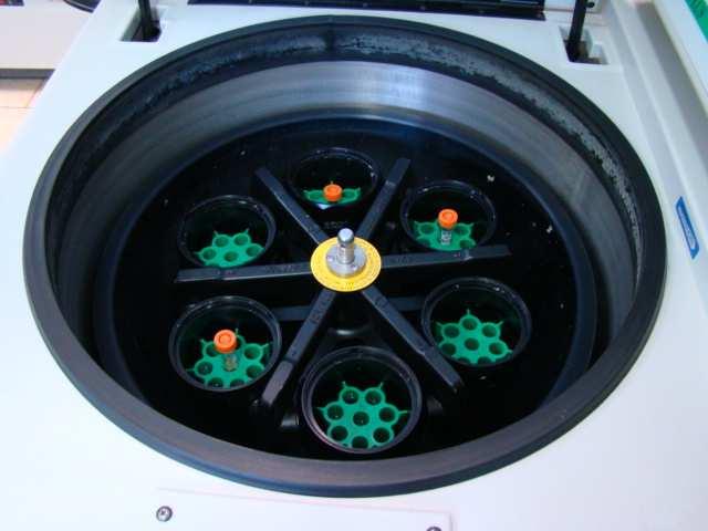 52 A B Figura 5. A: Centrifugação em centrifuga refrigerada de rotor horizontal. B: Recuperação do gradiente sobrenadante após a centrifugação. 5.5. Avaliação das características