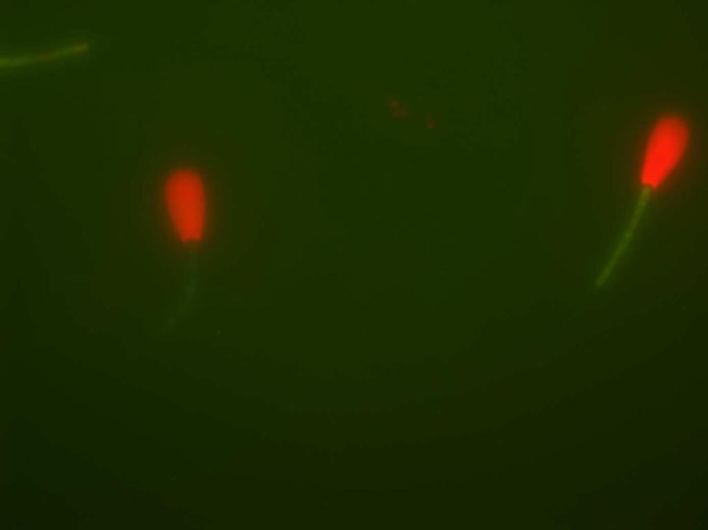 58 A B C Figura 9. Fotomicrografia de espermatozóides corados pela associação de corantes fluorescentes PI, FITC-PSA e JC-1.