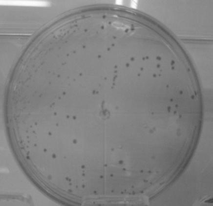 Gênero Fusobacterium F. alocis F.