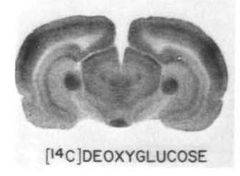 Desoxiglicose Primeiras