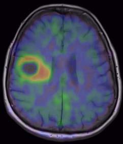 Biograph mmr Already, a large range of clinical