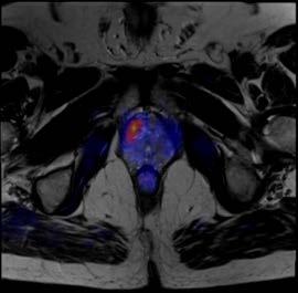 imaging fetuses and infants under two years of age.