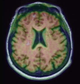 the MRI examination in comparison to other imaging