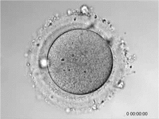 expandindo o volume Sassoni-Corsi Science, 2002 (Zhou e Dean, 2015) Após a fecundação, o DNA do prónucleo masculino substitui