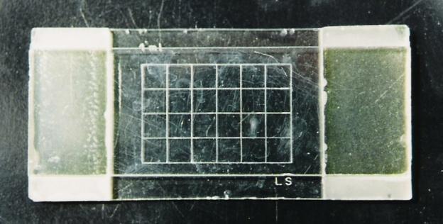 cocophilus em cada amostra foi realizada com o auxilio de um microscópio binocular Leica modelo CME com aumento de 100X (Fig. 10A) e de um contador de células Kácil modelo CCS-01 (Fig. 10B).