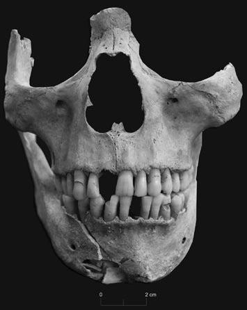 dentários). À semelhança do restante espólio, desconhece-se qualquer indicação da proveniência dos restos ósseos, com a excepção de duas Fig.