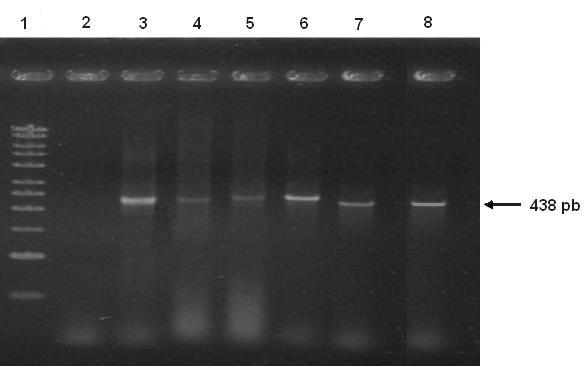 12 Extração de DNA a partir de coágulos sanguíneos bovinos 45