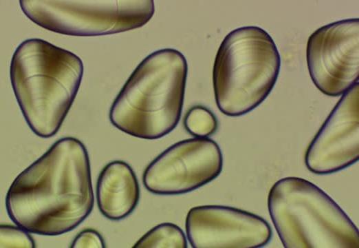 html Micrography Of Isolated Potato Starch Grains Viewed In Polarised Light Clearly Showing Growth