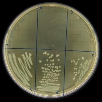 (Pentaclerathra macroloba) e patauá (Oenocarpus bataua) não apresentaram concentração inibitória mínima frente aos patógenos, dentro da faixa de concentração testada.