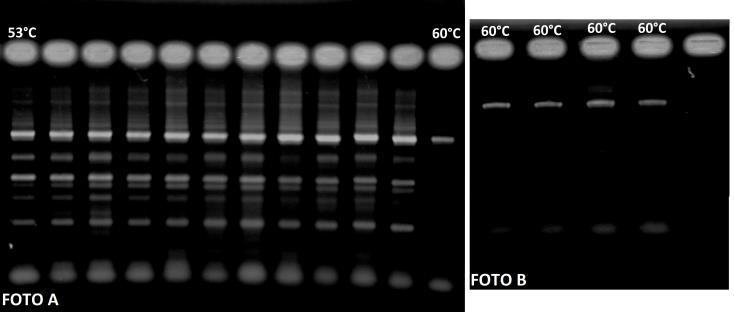 Figura 2 - Produtos de PCR em gradiente de temperatura visualizadas em gel de agarose 1,8%.