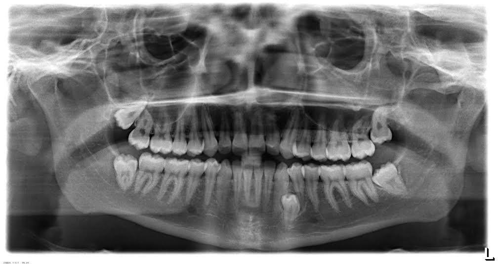 Universitária Egas Moniz Figura 5- Dentes