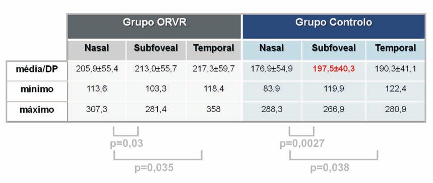 Espessura da Coróide na Oclusão de Ramo Venoso da Retina Tabela 2 Graf. 2 e 3 Comparação entre a espessura da coróide a nível macular no grupo ORVR e grupo controlo.